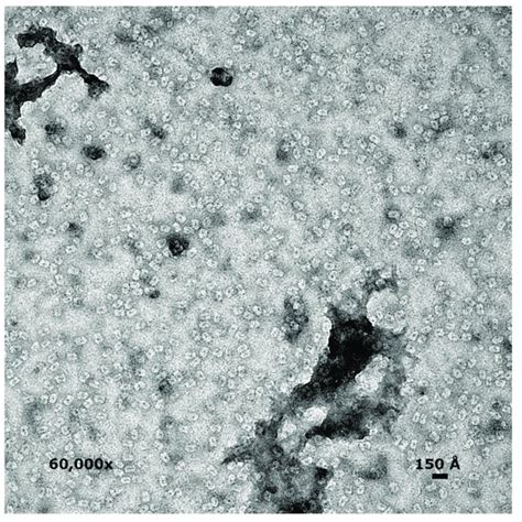 Uranyl acetate staining of gp11 showed cylindrical particles with ...