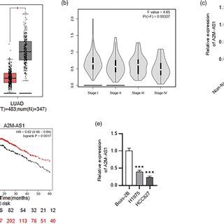 A2M AS1 Is Downregulated In LUAD A A2M AS1 Expression In LUAD Tissue