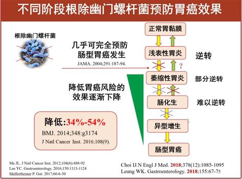 幽门螺杆菌与胃癌澎湃号·湃客澎湃新闻 The Paper