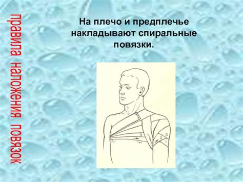 Правила наложения