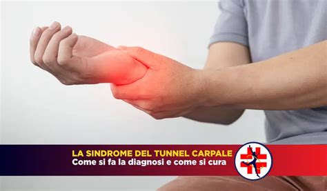 Sindrome Del Tunnel Carpale Come Si Cura Centro Medico SB