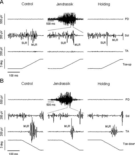 Inhibitory Effect Of The Jendrassik Maneuver On The Stretch Reflex Neuroscience