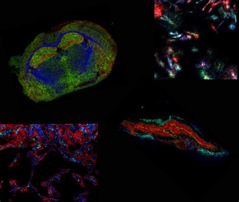 In Situ Single Cell Lipidomics By Imaging Mass Spectrometry