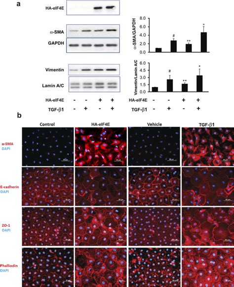 Ectopic Overexpression Of Eif E In Primary Lung Epithelial Cells