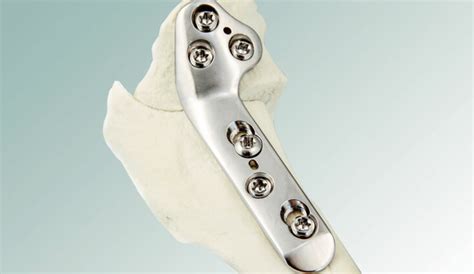 Meet The Elite Tplo Plate Veterinary Orthopedic Implants