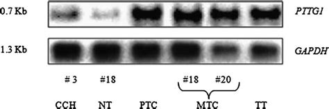 Northern Blot Analysis Of Pttg1 Gene Expression A Northern Blot