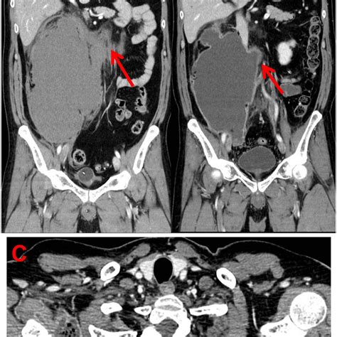 Thoracoabdominal Contrast Enhanced Computed Tomography Images A