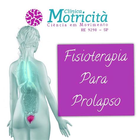 Fisioterapia P Lvica Para Prolapsos Cl Nica Motricit Ci Ncia Em