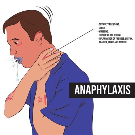 Anaphylaxis Causes Symptoms Diagnosis Treatment Off