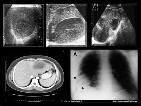 Morphology Trophozoite Pre Cyst Cyst Dr Manar Sobh Azab Ppt Download