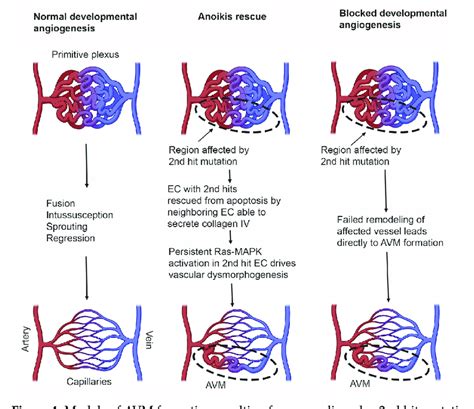 Models Of Avm Formation Resulting From Germline Plus 2nd Hit Mutation Download Scientific