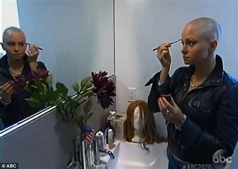 Being Bald In Hollywood Model And Actress Struck By Alopecia Reveals