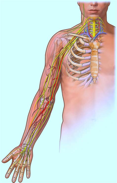 Dolor En El Brazo Izquierdo Derecho Causas Muscular Mujer Y Hombro