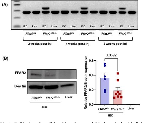 Figure 3 from The emergence of inflammatory microglia during gut ... 