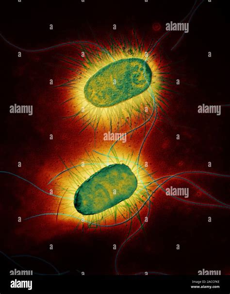 E Coli Bacteria Coloured Transmission Electron Micrograph Tem Of