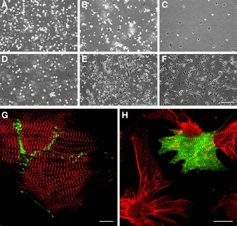 Isolation And Culture Of Neonatal Mouse Cardiomyocytes Video Jove