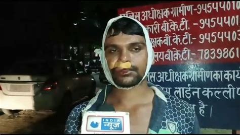 बीकेटी में सर्राफ से लूट विरोध पर बदमाशों ने दुकानदार को पीट पीटकर