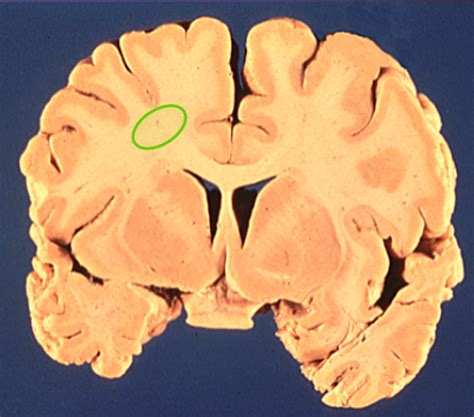 Chapter 19 Cerebral Cortex Flashcards Quizlet