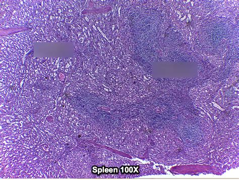 Spleen Diagram Quizlet