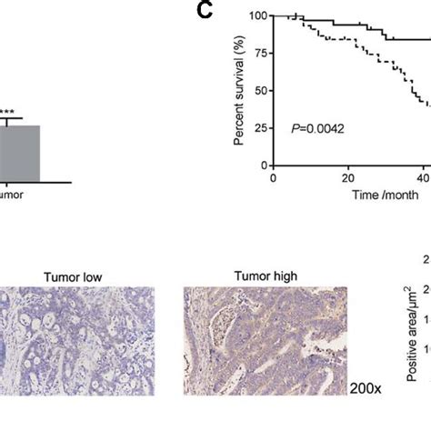 Arhgap Was Downregulated In Human Crc Tissues A The Relative Mrna