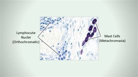 Toluidine Blue Stain Of Mast Cell Biology Notes Online