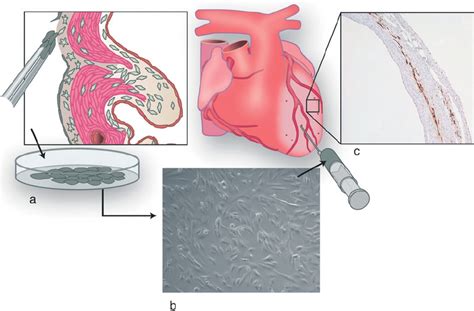 Illustration Of Epdc Transplantation Experiments A Adult Epicardial Download Scientific