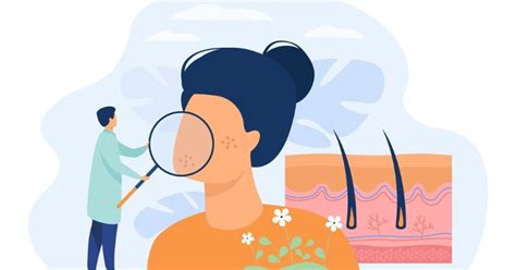 Средства для лечения акне на лице