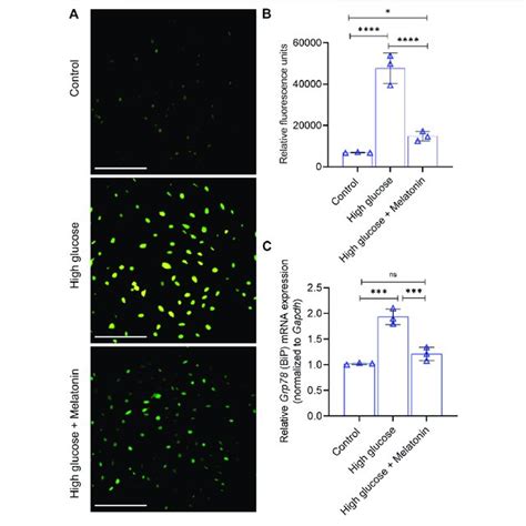 Melatonin Alleviates High Glucose Induced Er Stress A B Analysis Of