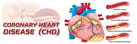 GitHub Rajivjha003 Cardiovascular Risk Prediction Cardiovascular