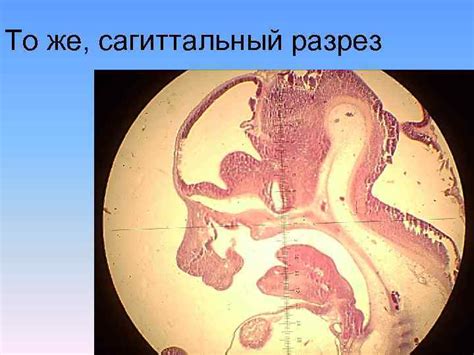 АНАТОМИЯ ПОЛОСТИ РТА Лекция чл корр РАЕ проф