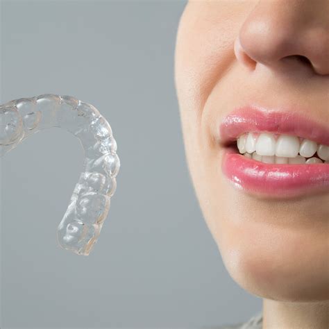 Para qué se utilizan los ataches de Invisalign Clínica Dental