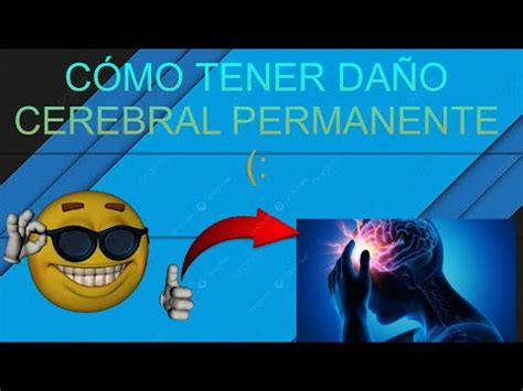 Cómo Tener Daño Cerebral Permanente Y Mucho Lag YouTube