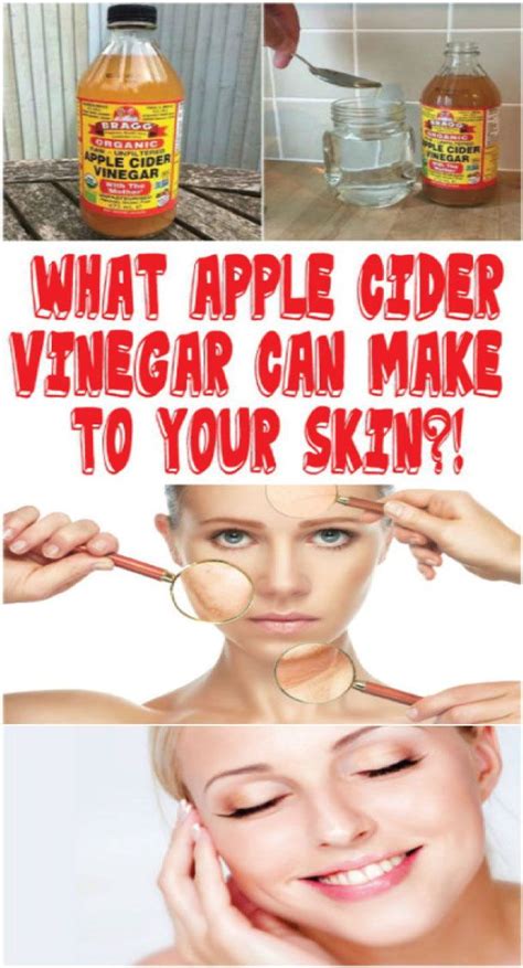 WHAT APPLE CIDER VINEGAR CAN MAKE TO YOUR SKIN | Apple cider vinegar for skin, Skin tags apple ...