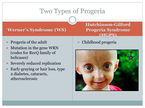 Ppt Progeria Powerpoint Presentation Free Download Id2137589