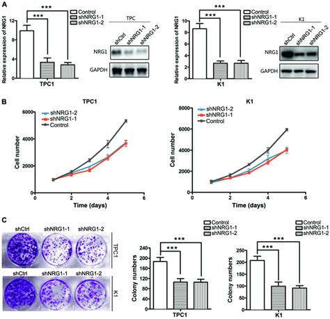 Nrg1 Regulates Redox Homeostasis Via Nrf2 In Papillary Thyroid Cancer