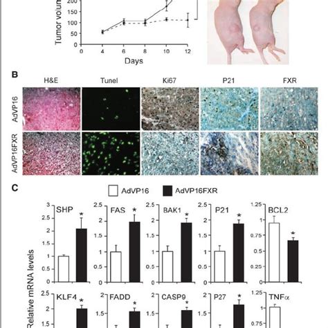 Reactivation Of Fxr In Colon Cancer Cells Via Adenoviral Infection