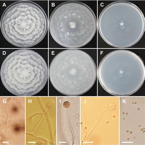 Morphology Of Mortierella Elongata Cnufc Yr329 1 A D Colony On Potato