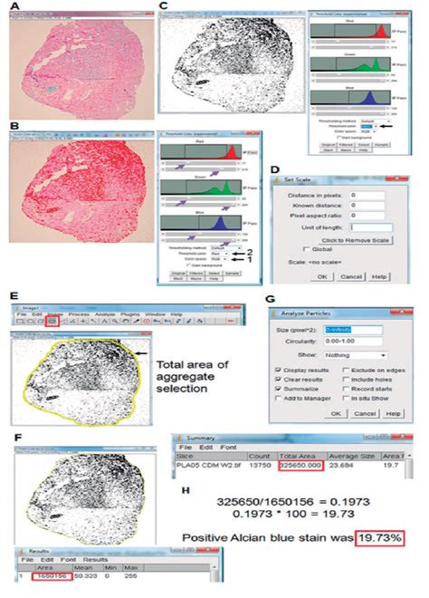 Figure 1 From Semi Automatic Grading System In Histologic And