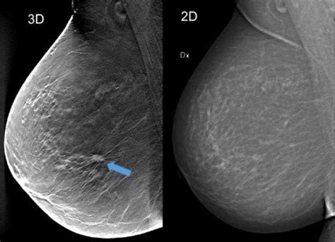 An Example Of 3d Vs Traditiona [image] Eurekalert Science News Releases