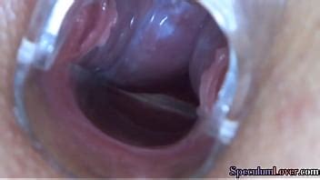 Speculum Babe Anally Fingered And Toyed In Erotic Couple XVIDEOS