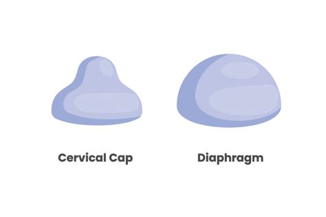 Cervical Cap. Explaining the Function and Usage