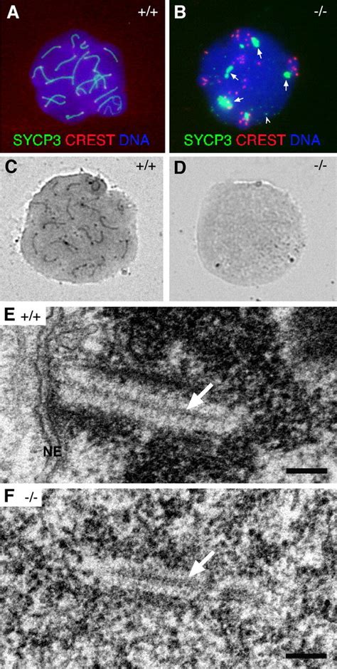 Analysis Of SC Formation In Sycp2 Spermatocytes Surface Spread