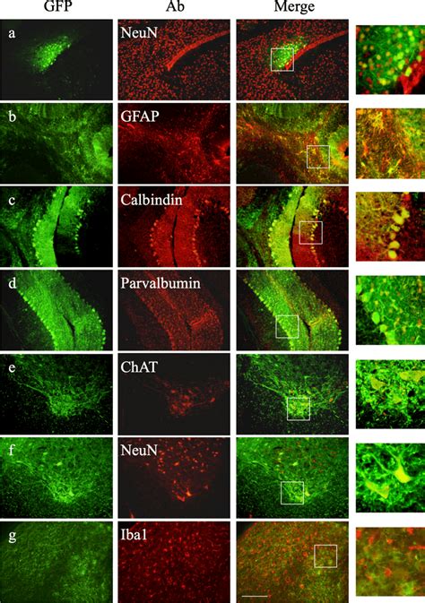 Immunohistochemical Analysis Of Transduced Cells In The Brain And