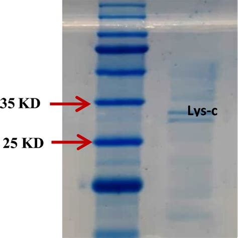 Sds Page Analyses Of Purified Lysyl Endopeptidase Eluted Lysyl