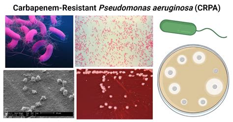 Pseudomonas Aeruginosa Ear Infection