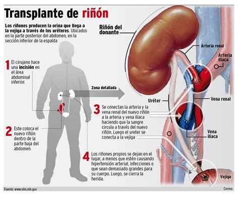 Los receptores de transplantes