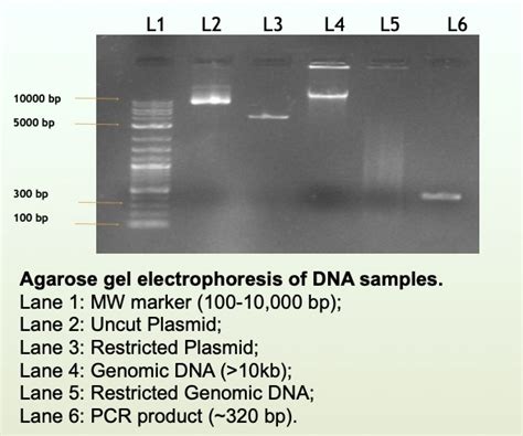 SOLVED L2 L3 L4 57 L6 10000 Bp 5000 Bp 300 Bp 100 Bp Agarose Gel