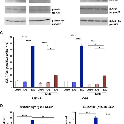 The AKT inhibitor (AKTi) reduces the androgen-induced cellular ... 