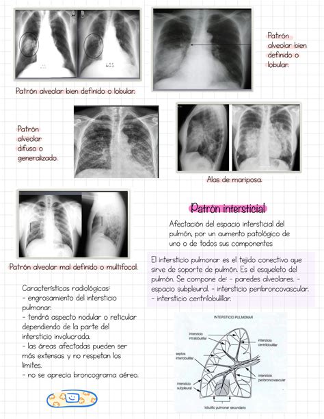 Solution Patrones Radiol Gico Studypool