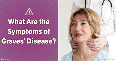 What Are the Symptoms of Graves’ Disease?